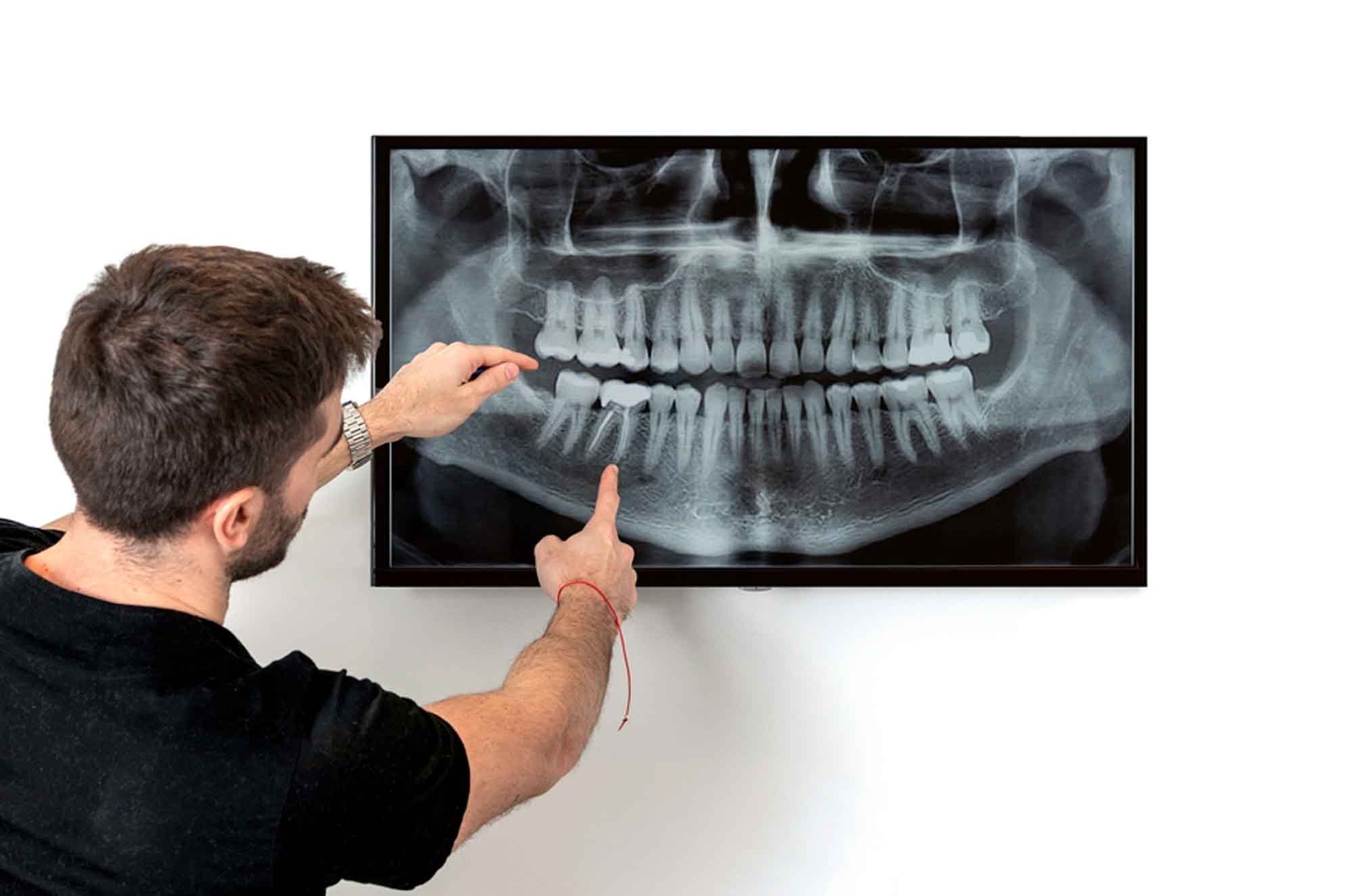 Panoramic Dental Imaging Dentist In Dubai Pearl Dental Clinic