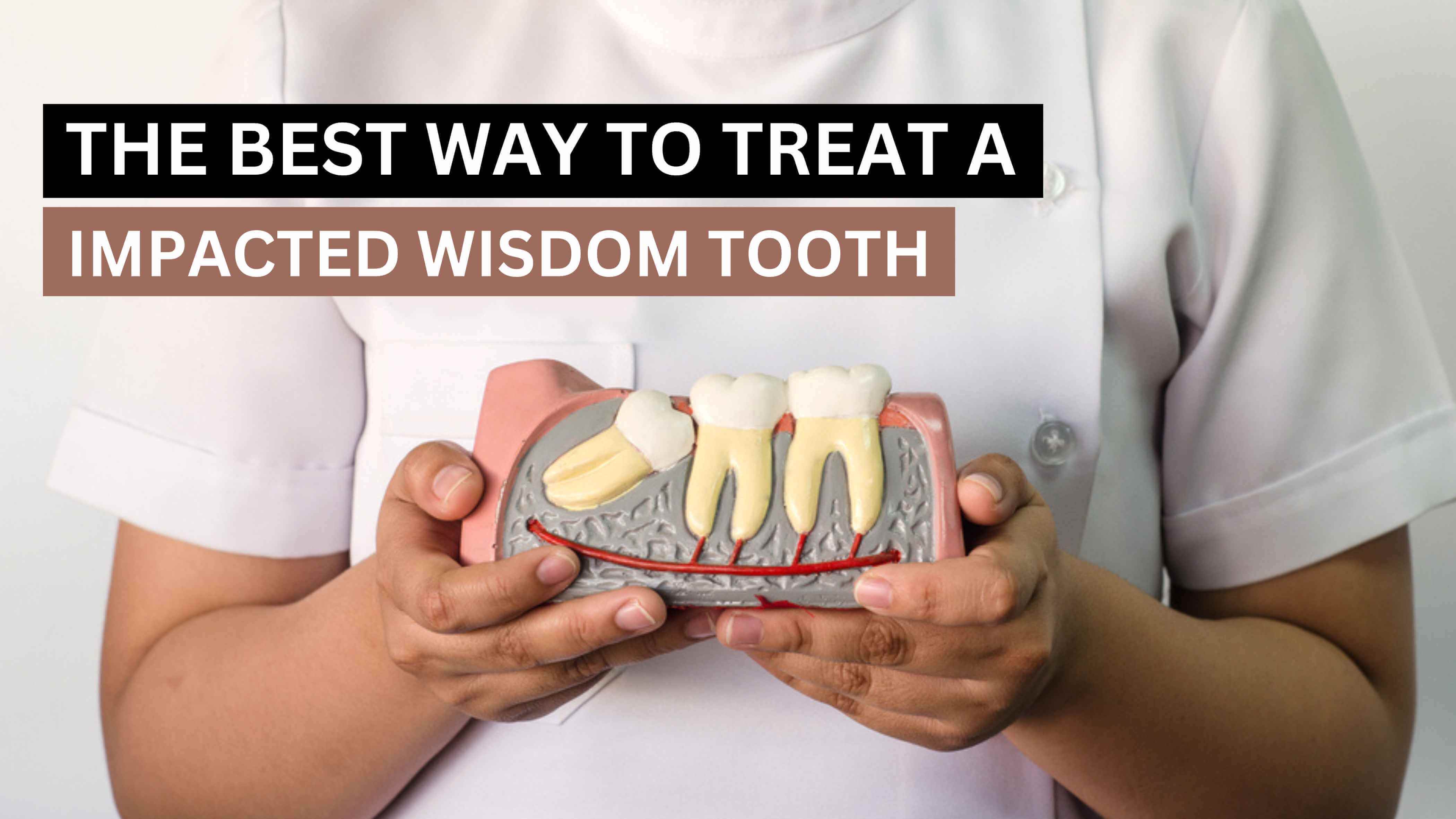 IMPACTED WISDOM TOOTH TREATMENT