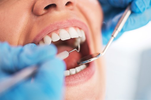 Oral Surgery Dubai