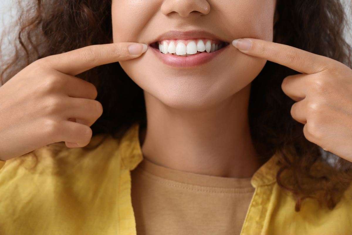 Are Dental Veneers Permanent? Exploring the Lifespan and Potential Considerations