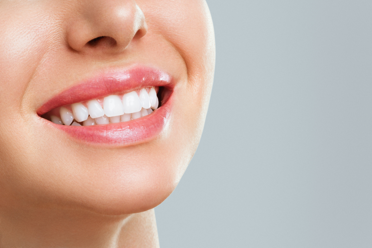 hollywood smile dental clinic dubai